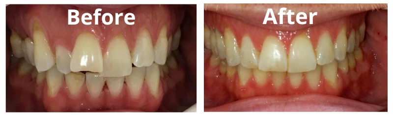 Dentist in Florham Park