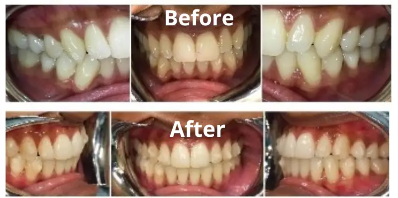 Dentist in Florham Park NJ